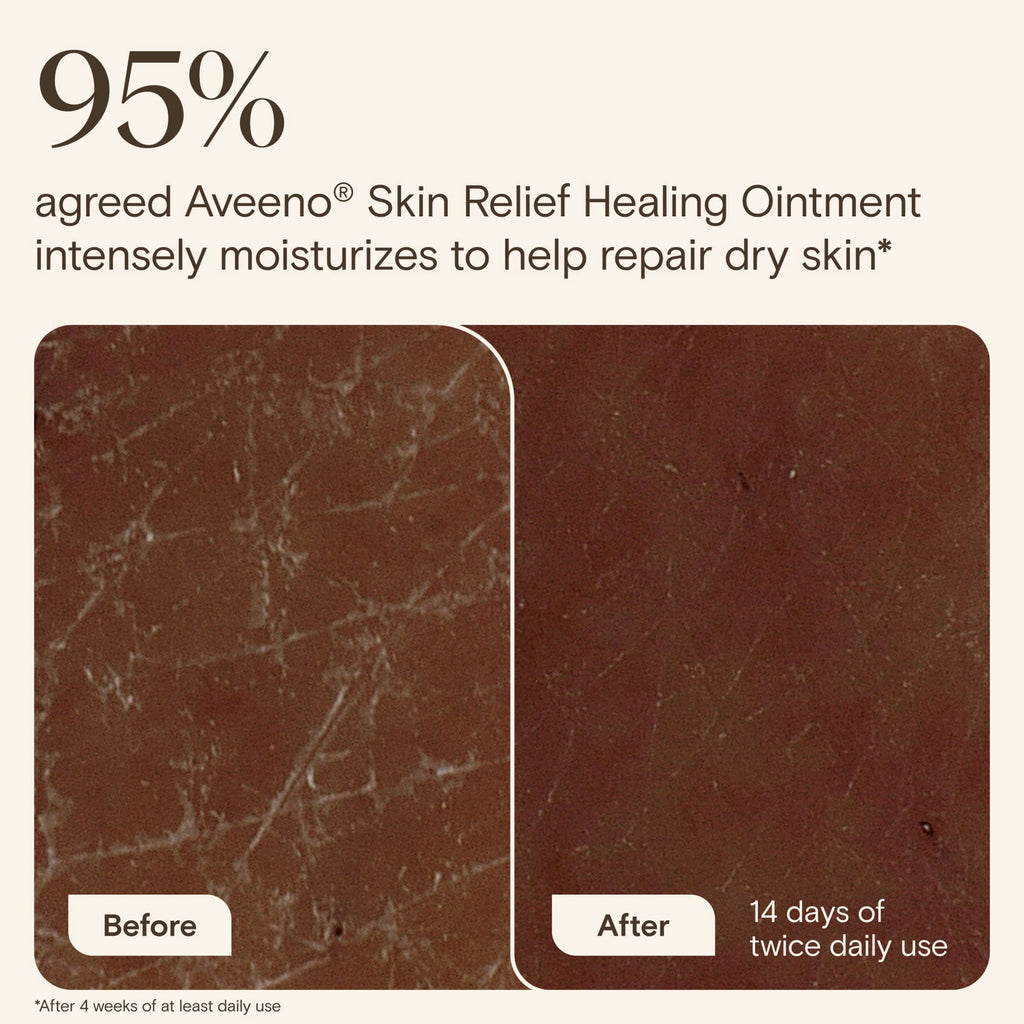 Aveeno Skin Relief Healing Ointment for Dry, Cracked Skin, Glycerin, Non-Greasy, 2 oz