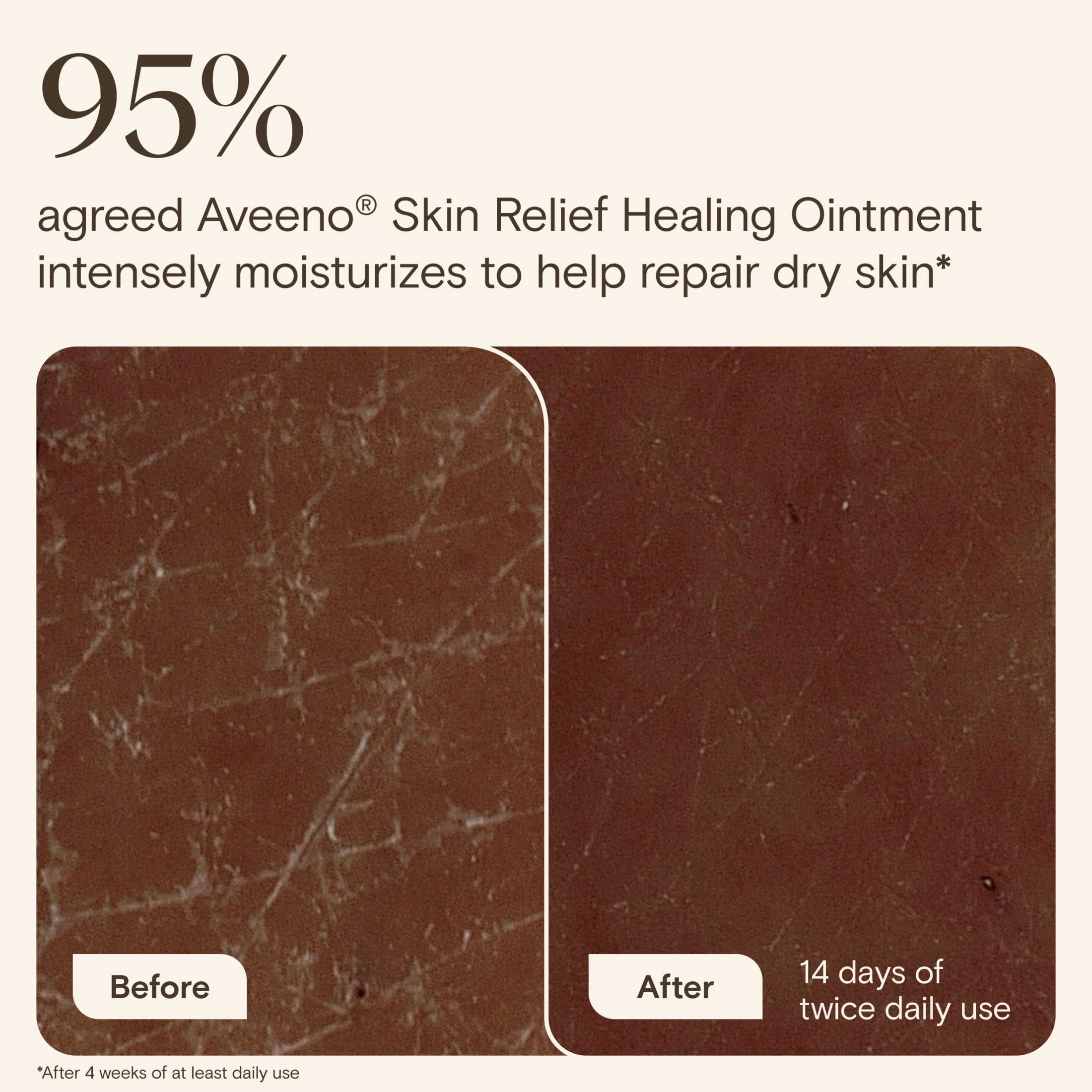 Aveeno Skin Relief Healing Ointment for Dry, Cracked Skin, Glycerin, Non-Greasy, 2 oz