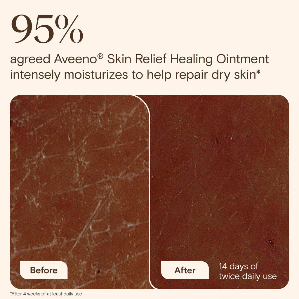 Aveeno Skin Relief Healing Ointment for Body & Face 7.2 oz