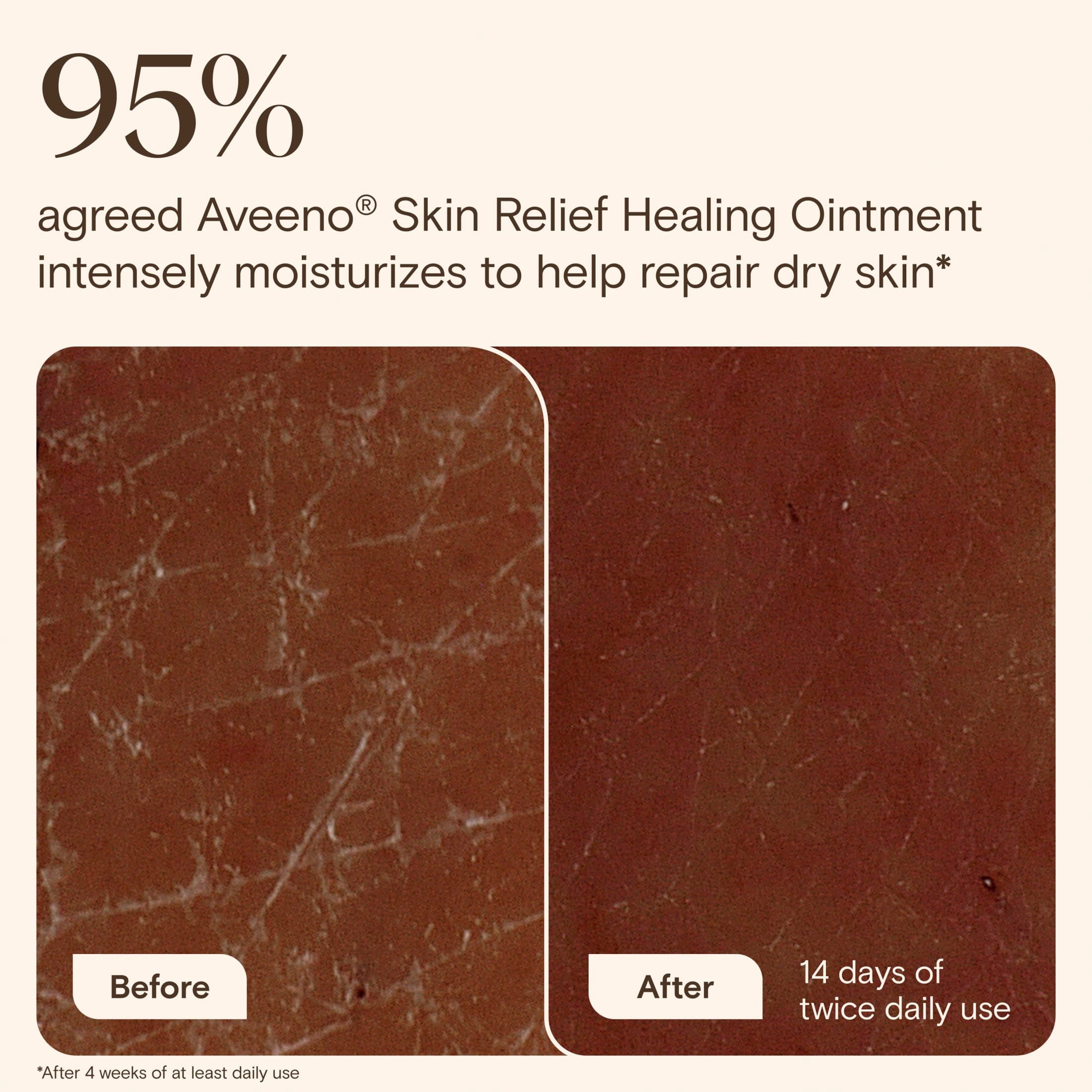 Aveeno Skin Relief Healing Ointment for Body & Face 7.2 oz